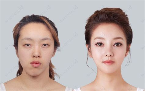 No.1 Korean Plastic Surgery 【ID Hospital .